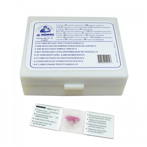 Набір слайдів Konus Патологічні тканини людського тіла, частина II (10 шт.), код: 4915-DB Набір слайдів Konus Патологічні тканини людського тіла, частина II (10 шт.), код: 4915-DB