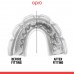 Капа Opro Instant Single Colour Braces доросла (вік 11+) Clear, код: Instant_Braces_Clear